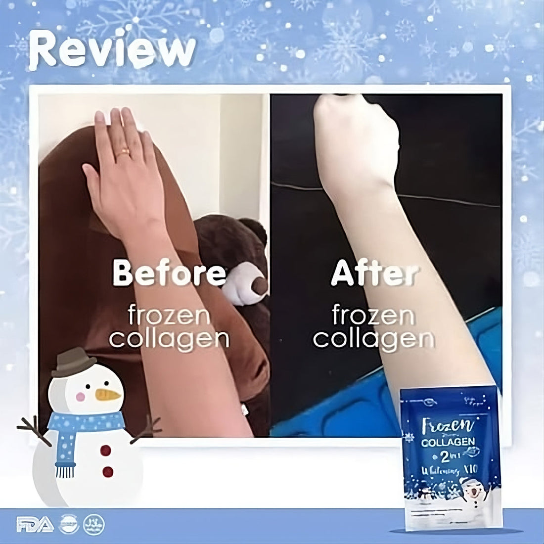 Gluta Frozen Collagen 2 In 1 Capsules - Before and After Visual 1