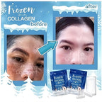 Gluta Frozen Collagen 2 In 1 Capsules - Before and After Visual 2